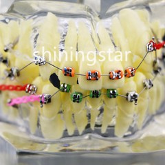 Dental Orthodontic Treatment Teeth Model Malocclusion Study Brackets Demo 3005-3