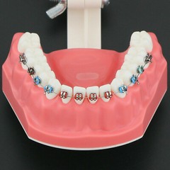 Dental High Quality Orthodontic Demonstration Model With Brackets Buccal Tubes