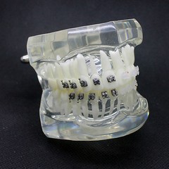 Dental Ceramic Metal Brackets Clear Orthodontic Study Model 3003