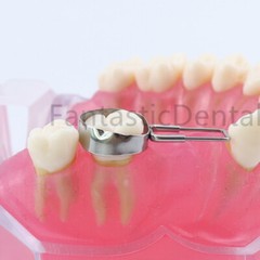 Dental Space Retainer Band Adjacent Teeth Maintainer Bands Miss Molar 32# to 41#