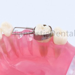 Dental Space Retainer Band Adjacent Teeth Maintainer Bands Miss Molar 32# to 41#