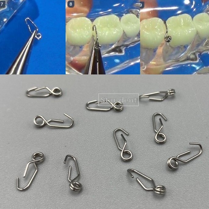 Dental Ortho Self-Lock Separating Springs Separate Steel Separator Spring