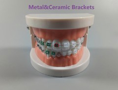 1Pcs Dental Orthodontic Treatment Model With Ceramic/Metal Brackets Study Model
