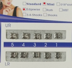 Dental Orthodontic Metal Braces Brackets MIM Mini Edgewise 022 Slot no hooks