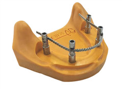 Dental Twist Ti Prosthesis Strengthener Wires fit Implant 4 inch Length Bredent