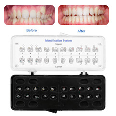 Orthodontic Metal Brackets Standard Roth/MBT Braces .022/.018 Hooks 3-4-5 20/Set
