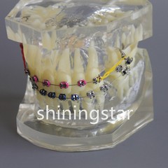 Dental Orthodontic Teeth Model Study Treatment Demo Bracket Wire Ligature 3005-2