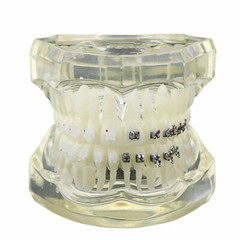 1Pcs Dental Orthodontic Teeth Model Metal Ceramic Brackets Study Model 3003