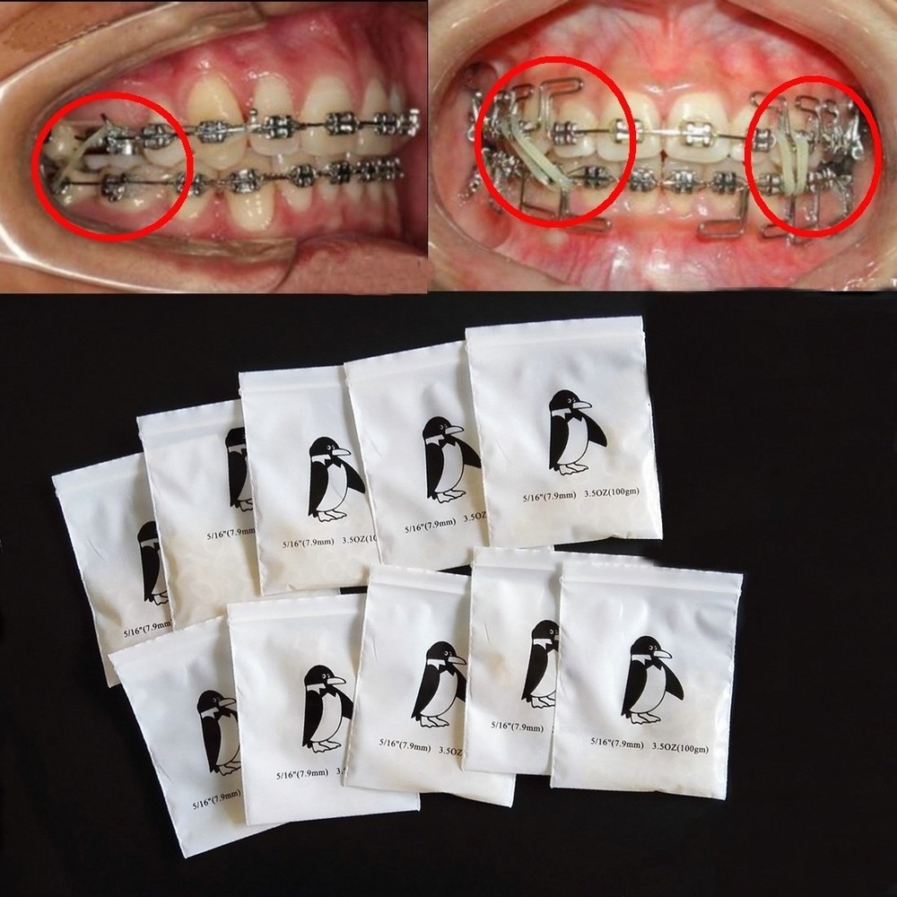 Dental 10 packs orthodontic elastic rubber bands Penguin 3.5 OZ,1/8″ 100pcs/pack