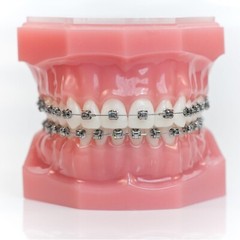 Dental Ormco Damon Brackets Orthodontic Self Ligating Ceramic Metal Roth MBT 022