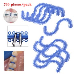 1-10 Bags Dent Orthodontic Separator Tie Blue Color Spacer S type for dentists