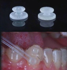 Dental Lingual Button Ceramic Clear Invisable Retainer Aligner Bondable Round