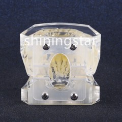 Dental Orthodontic Treatment Teeth Model Malocclusion Study Brackets Demo 3005-3