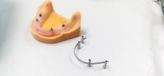 Dental Twist Ti Prosthesis Strengthener Wires fit Implant 4 inch Length Bredent