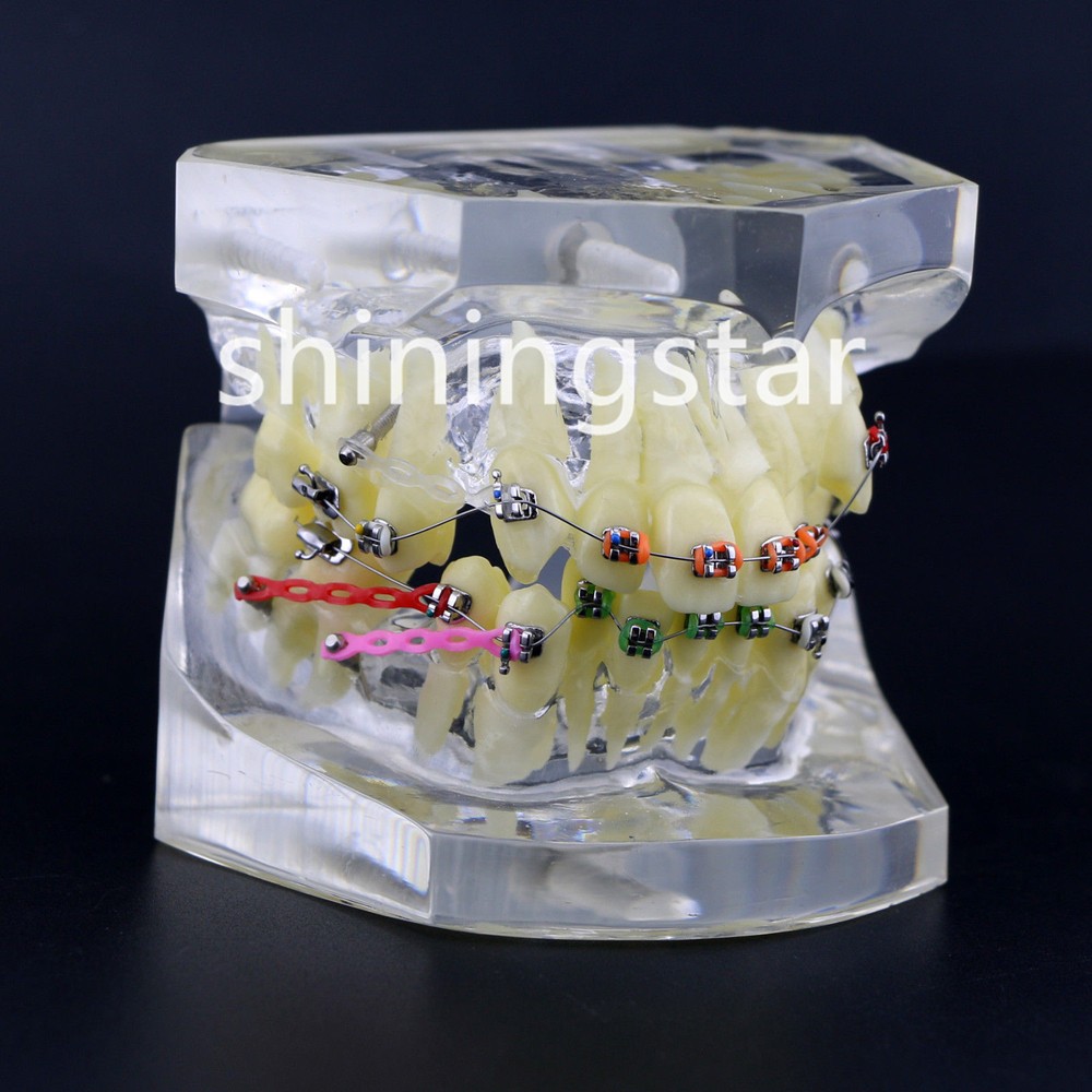 Dental Orthodontic Treatment Teeth Model Malocclusion Study Brackets Demo 3005-3