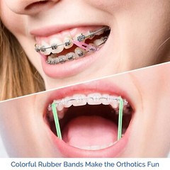 JMU Orthodontic Elastics Light Medium Heavy Neon Ortho Rubber Bands Latex Free