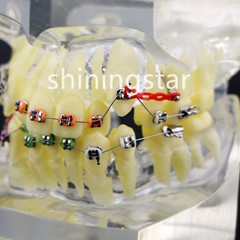 Dental Orthodontic Treatment Teeth Model Malocclusion Study Brackets Demo 3005-3