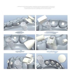 Dental Orthodontic Mould Starter Kit Lingual Button Tongue Tamer Injection Mould