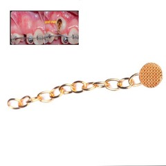 Dental Ortho Lingual Button Traction Chain Round Golden Plated Round Rectangular