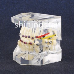 Dental Orthodontic Treatment Teeth Model Malocclusion Study Brackets Demo 3005-3