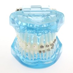 1Pcs Dental Orthodontic Teeth Model With Metal Ceramic Brackets Study Blue 3003