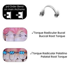 10Pcs/Bag Dental Orthodontic Tooth Torque Spring 16*22/17*25/18*25/19*25 Medium