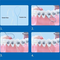 Dental Ortho Tube Wire Bite Mould Mini Accessories Injection Bracket&Lingual Kit