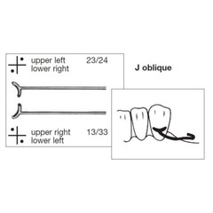 Dental Ball Retainer J Clasp Oblique Clasps Bars 0.8mm 0.9mm Y-Type Scheu Style