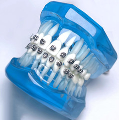 Dental Orthodontic 28Pcs/Set Q-type Self-Ligating Brackets ROTH 0.022 345 Hook