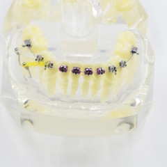 Dental High Quality Metal Brackets Wires Ties Chains Malocclusion Study Model