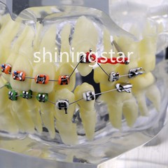 Dental Orthodontic Treatment Teeth Model Malocclusion Study Brackets Demo 3005-3