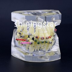 Dental Orthodontic Treatment Teeth Model Malocclusion Study Brackets Demo 3005-3