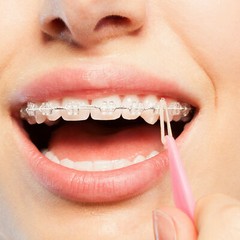 100PCS JMU Dental Orthodontic Intraoral Elastic Latex-Free Rubber Band Clear USA