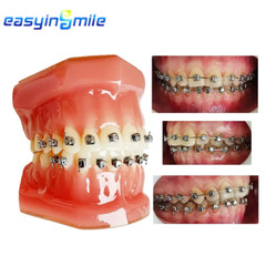 Dental Orthodontic Self Ligating Bracket Ortho Braces ROTH/MBT.022 Easyinsmile