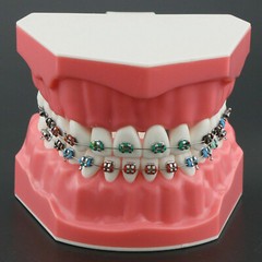Dental High Quality Orthodontic Demonstration Model With Brackets Buccal Tubes