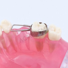 10-Size Dental Teeth Missing Maintainer Bands Space Retainer Band Molar Adjacent