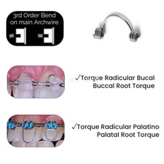10pcs/Pack Dental Orthodontic Anterior Teeth Torque Rectangular Springs SS