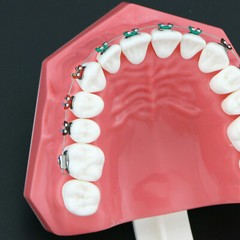 Dental High Quality Orthodontic Demonstration Model With Brackets Buccal Tubes
