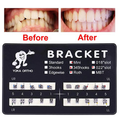 YOKA Dental Ortho Metal Brackets Braces Mini/Standard Roth/MBT 022/018 3/345 H