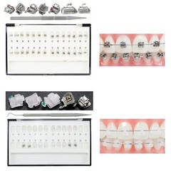 Dental Ormco Damon Brackets Orthodontic Self Ligating Ceramic Metal Roth MBT 022