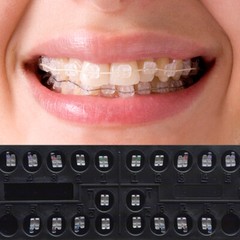 J&J Ortho™ CLARO™ Sapphire Orthodontic Bracket Roth/MBT 018/022 Hubit