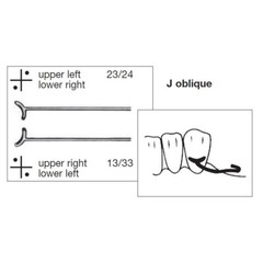 0.8/0.9/1.0mm Dental Ball Retainer J Clasp Oblique Clasps Bars Y-Type Scheu 10pc