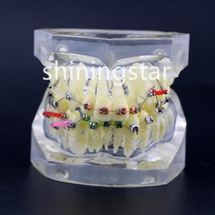 Dental Orthodontic Treatment Teeth Model Malocclusion Study Brackets Demo 3005-3