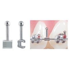 J&J Ortho™ 3Packs Orthodontic Crimpable Archwire Hooks (Short/Medium/Long)