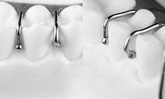 10Pcs Dental Ball Retainer J Clasp Oblique Clasps Bars Y-Type Scheu Style 0.7/8