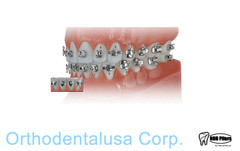 NATURAL ORTHODONTIC BRACKET Stal ALEXANDER SLOT 0.022 Hook 3/4/5 – 20 pcs