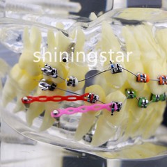 Dental Orthodontic Treatment Teeth Model Malocclusion Study Brackets Demo 3005-3