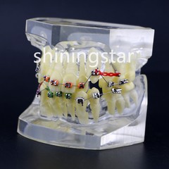 Dental Orthodontic Treatment Teeth Model Malocclusion Study Brackets Demo 3005-3