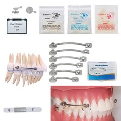 Dental Orthodontic Class II Distalizer Kit Clear Corrector Hook Button 16–27mm