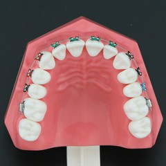 Dental High Quality Orthodontic Demonstration Model With Brackets Buccal Tubes
